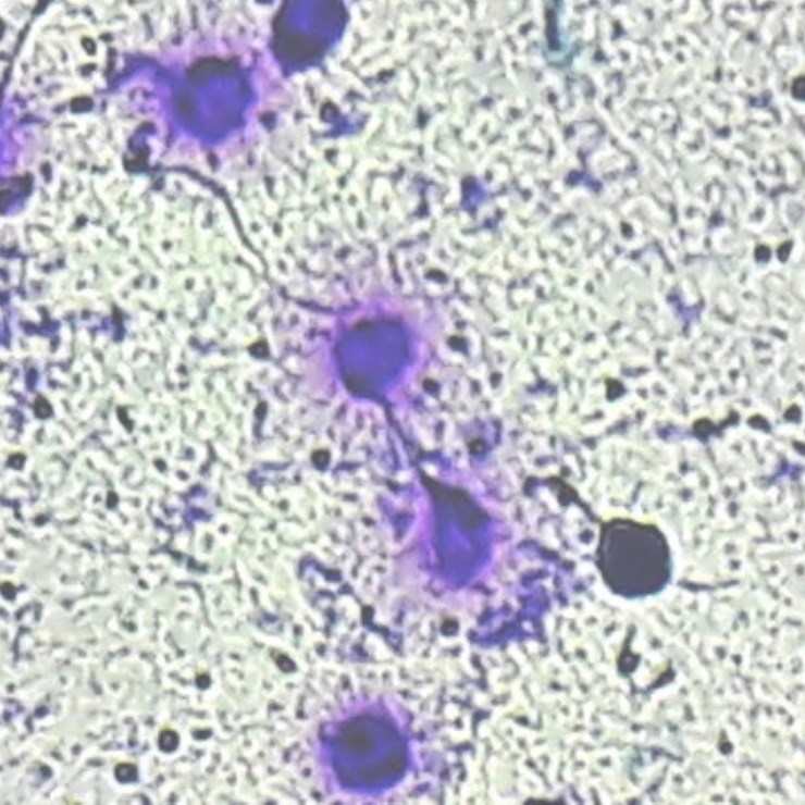 Frammentazione DNA